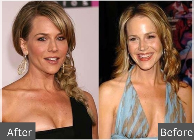 Julie Bowen's Plastic Surgery