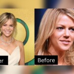 Kaitlin Olson's Plastic Surgery