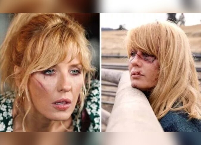 Kelly Reilly's Plastic Surgery