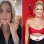 Kristin Cavallari's Plastic Surgery