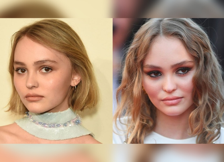 Lily-Rose Depp Plastic Surgery 2024