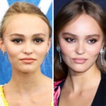 Lily-Rose Depp's Plastic Surgery