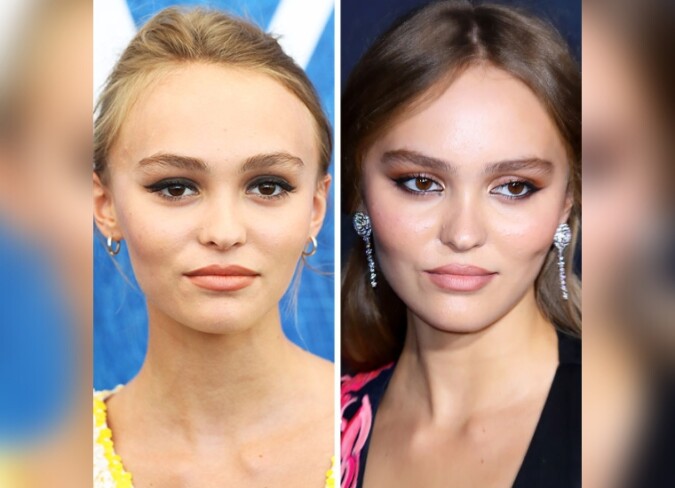 Lily-Rose Depp's Plastic Surgery