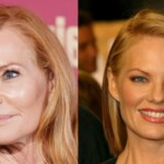 Marg Helgenberger's Plastic Surgery