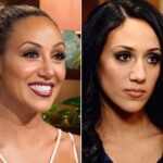 Melissa Gorga's Plastic Surgery