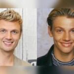 Nick Carter's Plastic Surgery