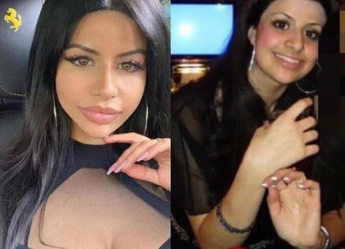yungsweetro before plastic surgery Image 1