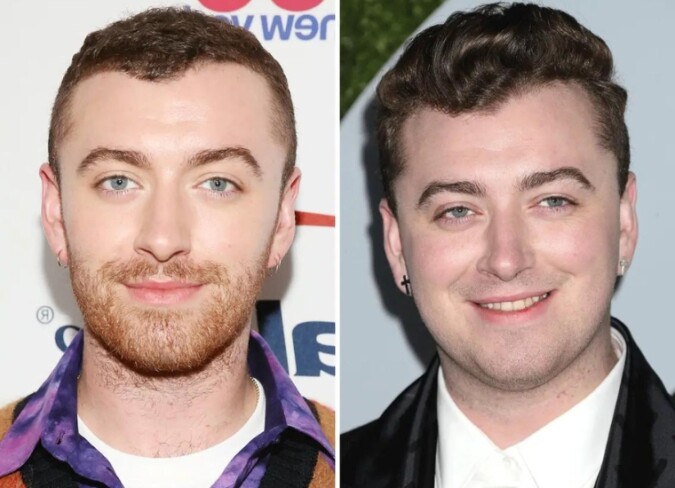 Sam Smith Weight Gain