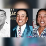 Smokey Robinson's Plastic Surgery