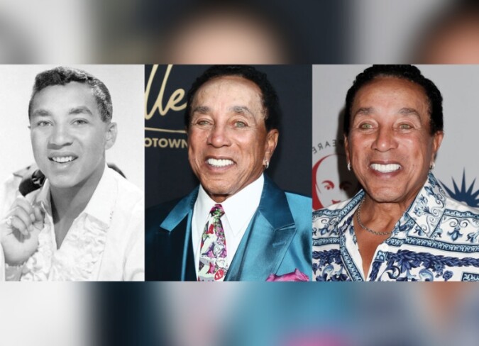 Smokey Robinson's Plastic Surgery