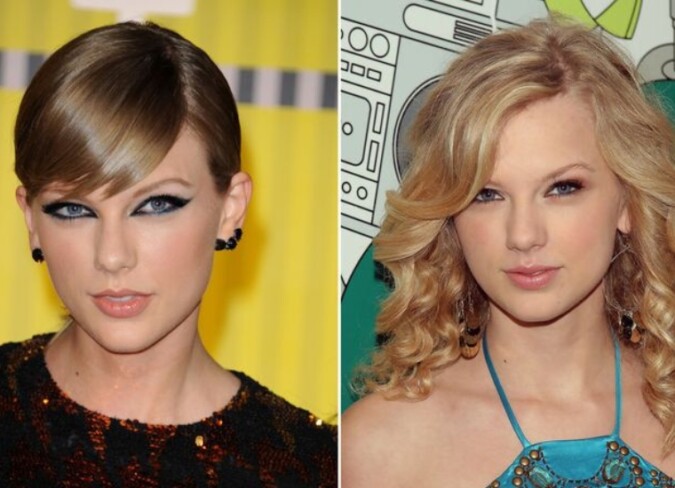 Taylor Swift Plastic Surgery