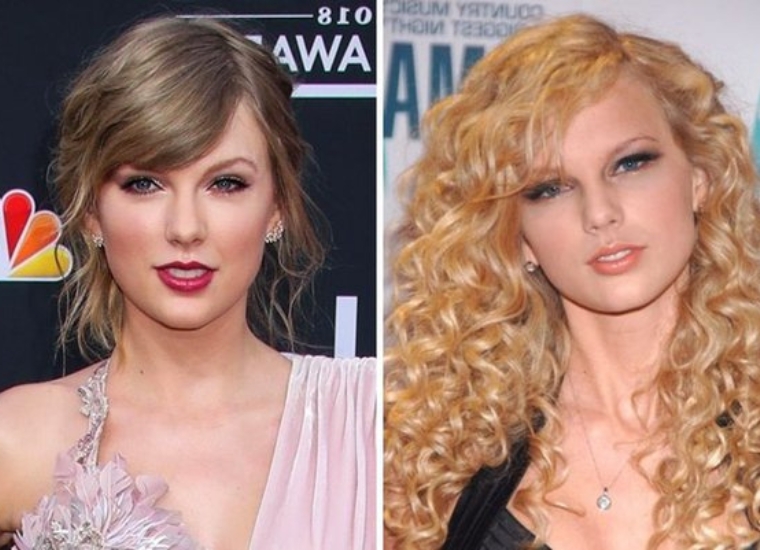 Taylor Swift Plastic Surgery Before And After