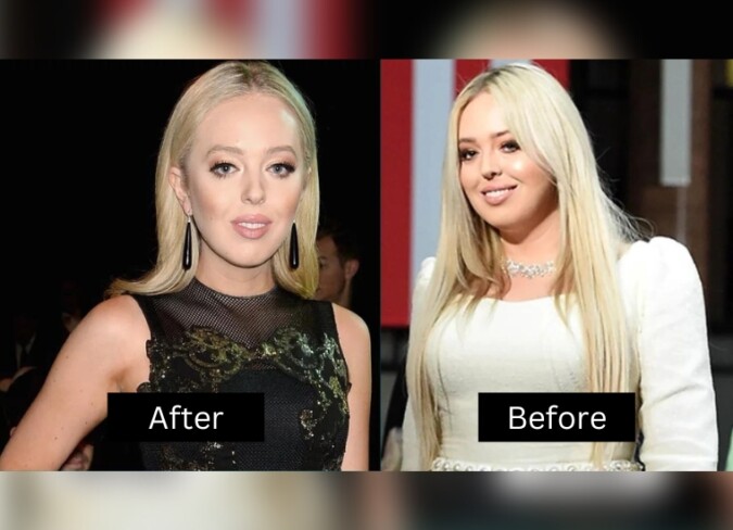 Tiffany Trump's Weight Loss