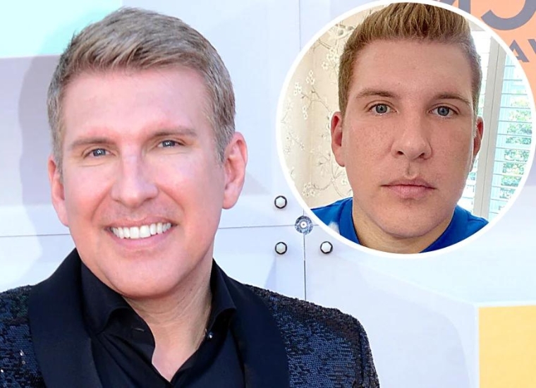 Todd Chrisley Plastic Surgery 2024