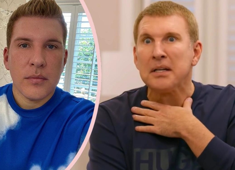 Todd Chrisley Plastic Surgery