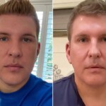 Todd Chrisley's Plastic Surgery