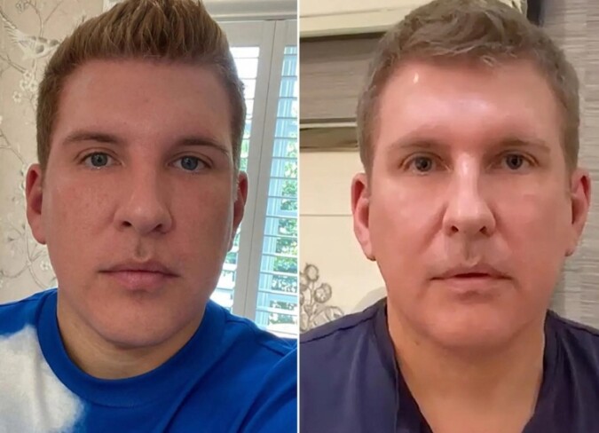 Todd Chrisley's Plastic Surgery