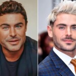 Zac Efron's Plastic Surgery