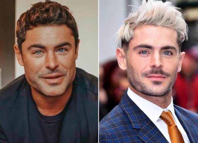 Zac Efron's Plastic Surgery