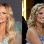 Carrie Underwood Plastic Surgery