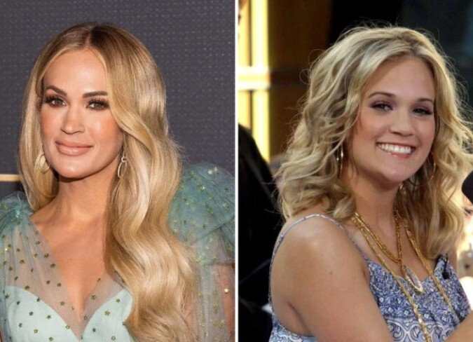 Carrie Underwood Plastic Surgery