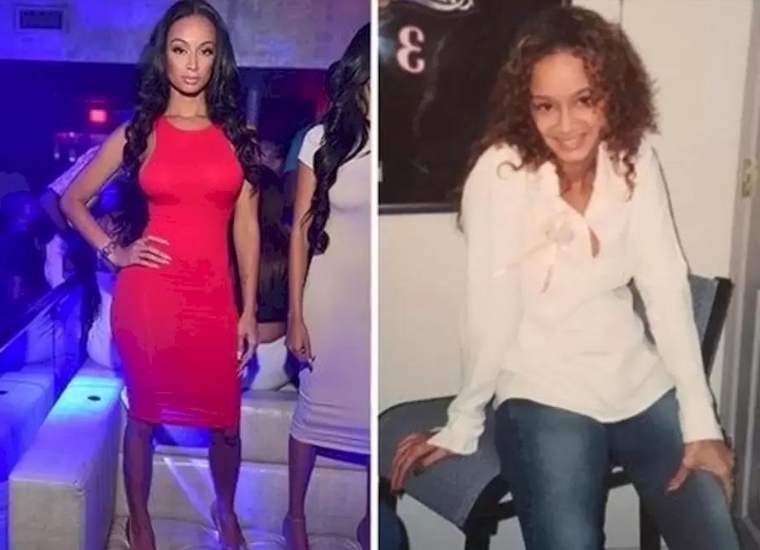 Erica Mena Plastic Surgery 2024