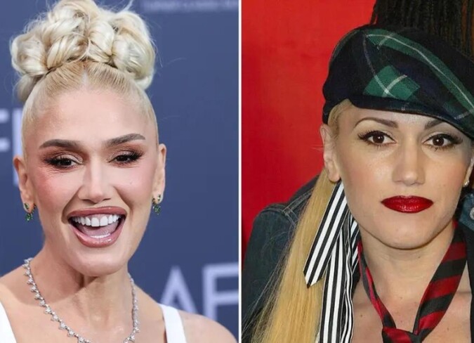 Gwen Stefani Plastic Surgery