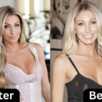 Heather Altman Plastic Surgery