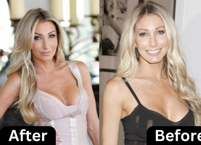 Heather Altman Plastic Surgery