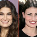 Idina Menzel Plastic Surgery