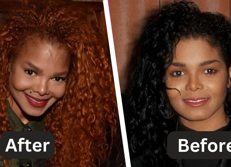 Janet Jackson Plastic Surgery 2024