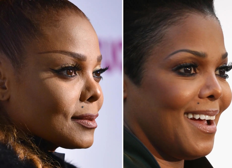 Janet Jackson Plastic Surgery Her Nose Job