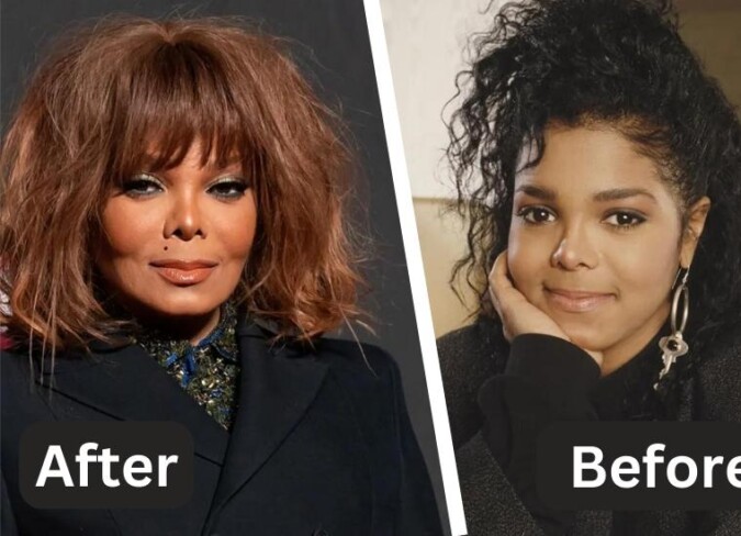 Janet Jackson Plastic Surgery