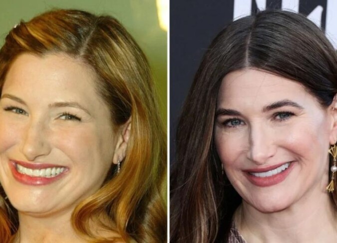 Kathryn Hahn Plastic Surgery