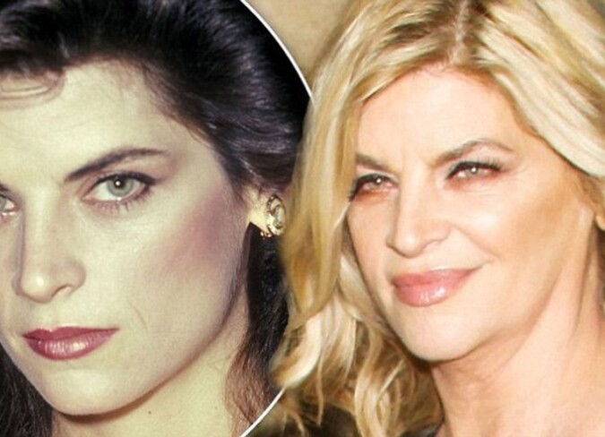 kirstie alley plastic surgery Image 8