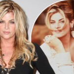 Kirstie Alley Plastic Surgery