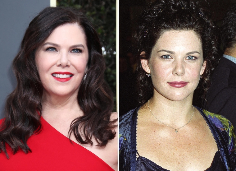 Lauren Graham Plastic Surgery 2024