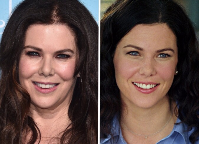 Lauren Graham Plastic Surgery