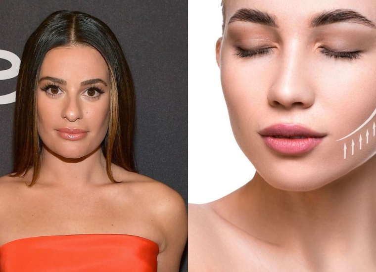 Lea Michele Nose Job