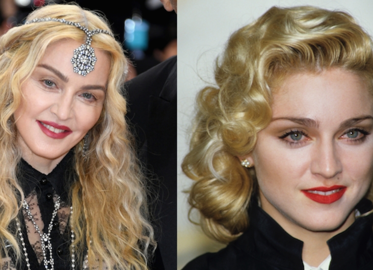 Madonna Plastic Surgery 2023
