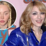 Madonna Plastic Surgery Daily Mail