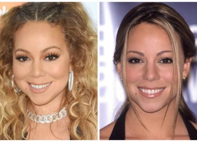 Mariah Carey Plastic Surgery