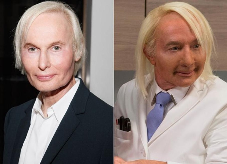 Martin Short Before And After Surgery