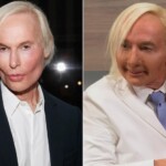 Martin Short Plastic Surgery