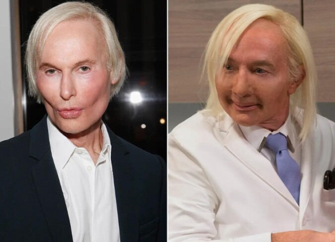 Martin Short Plastic Surgery