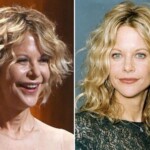 Meg Ryan Plastic Surgery