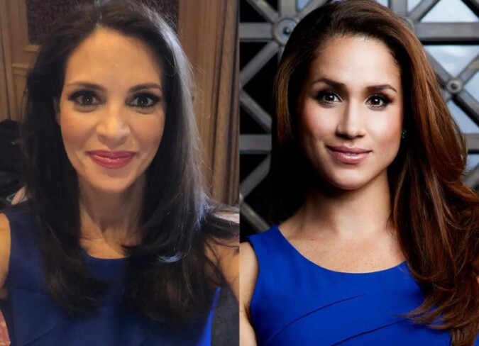 Meghan Markle Plastic Surgery