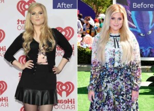 Meghan Trainor Weight Loss: Everything You Should Know About Meghan's Weight Gain And Weight