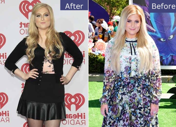 Meghan Trainor Weight Loss