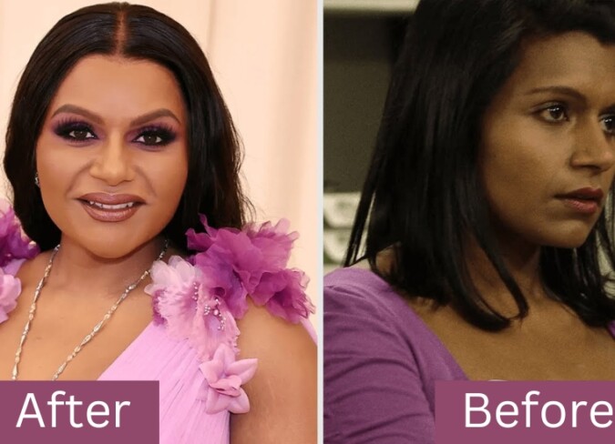 Mindy Was Never Happy With Her Facial Looks